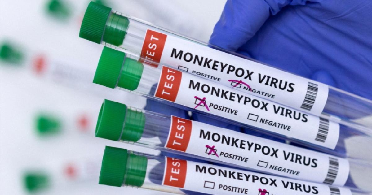 Cacar monyet akan dinamakan mpox – WHO