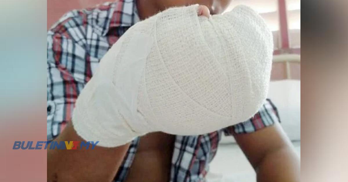 17 kes cedera akibat mercun direkodkan di Kelantan