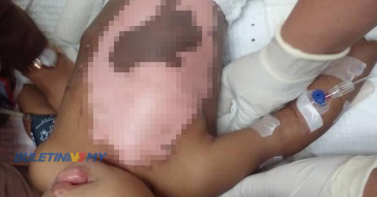 [VIDEO] Bayi melecur teruk, tubuh tersiram kuah kacang panas