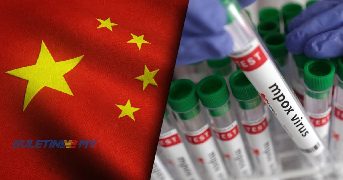 China kesan strain baharu virus mpox